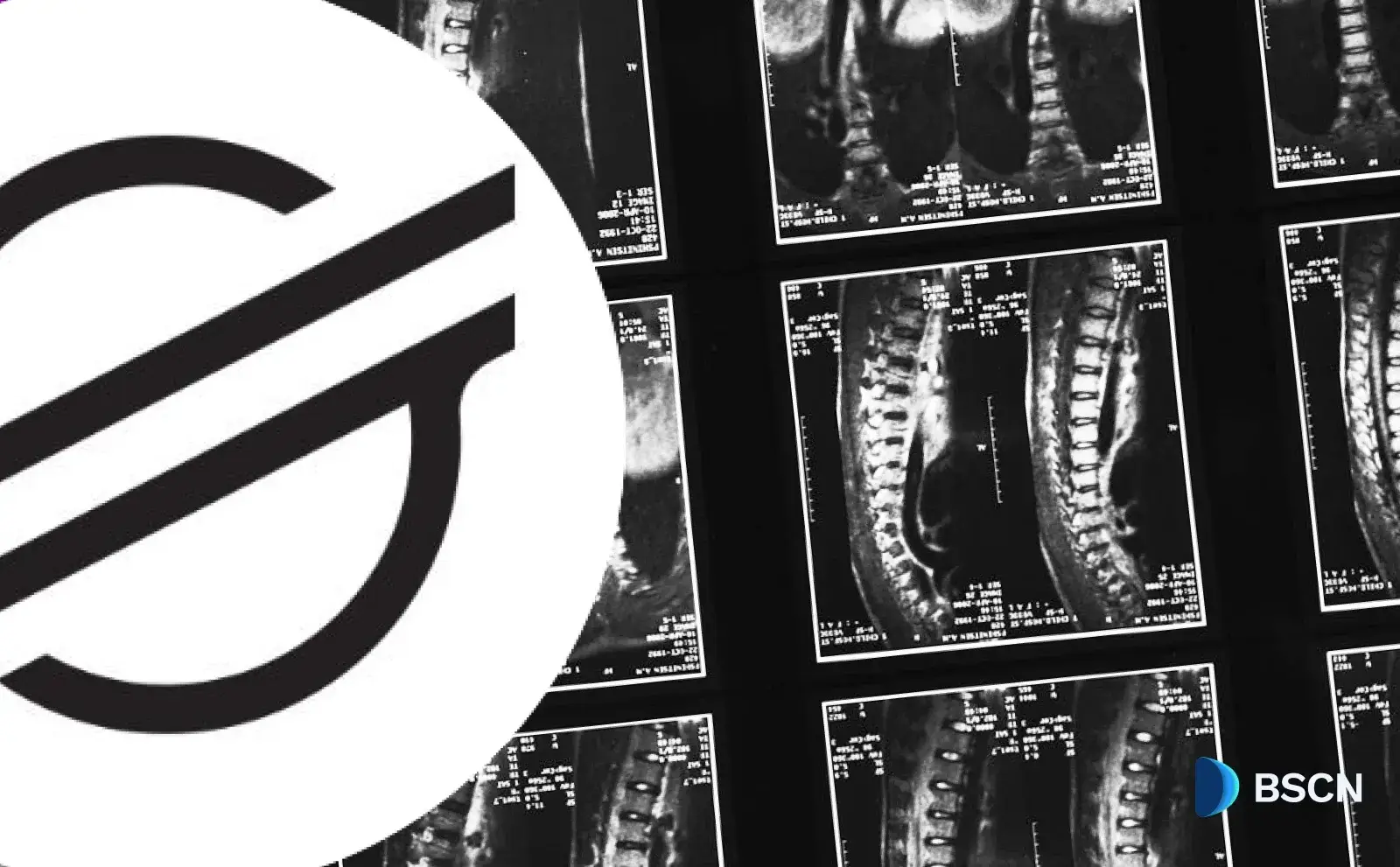 Stellar Network to Bring Privacy with Protocol X-Ray in Major Network Upgrade